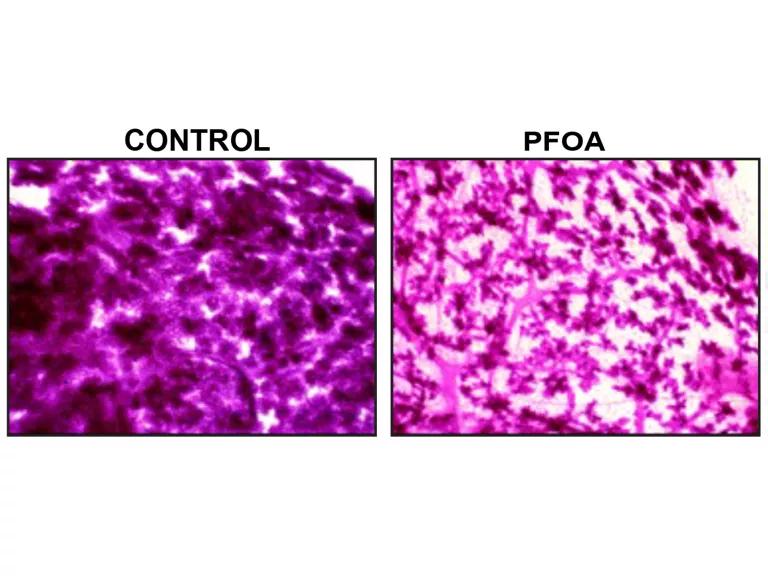 Mammary glands taken from female mice on gestation day 18 (one day before birth) should be saturated with milk-filled alveoli (left). However, mammary glands from PFOA-exposed mothers are not—their development is delayed (right).