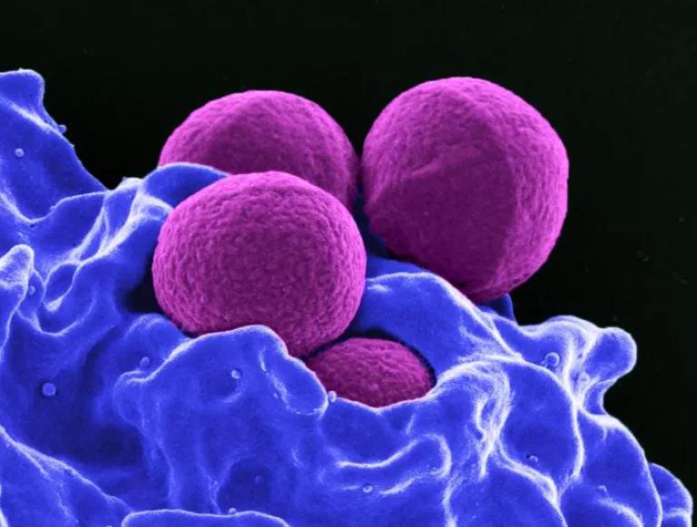 SEM image of Methicilin-resistant Staphylococcus aureus (MRSA)