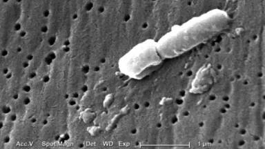 Klebsiella.jpg