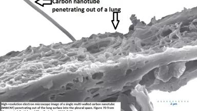 High-resolution electron microscope image of a single multi-walled carbon nanotube (MWCNT) penetrating out of the lung surface into the pleural space